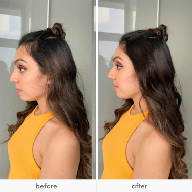 Hair Transformation