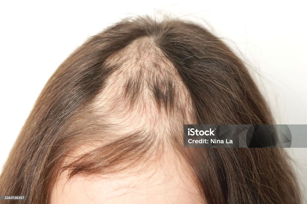 Istockphoto 2263138257 1024X1024